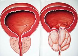 prostate gland